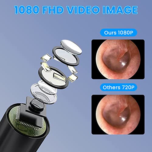 Verilux®Ear Wax Remover Tool Kit Camera for iOS & Android
