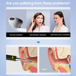 Verilux Ear Wax Remover Tool Kit with 6 Axis Gyroscope 5MP 1080P Camera & UV Lamp